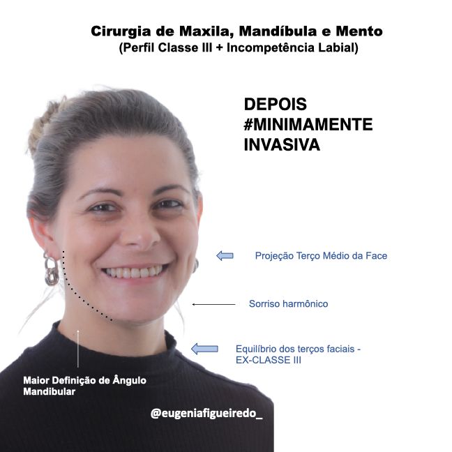 Eugênia Figueiredo-31
