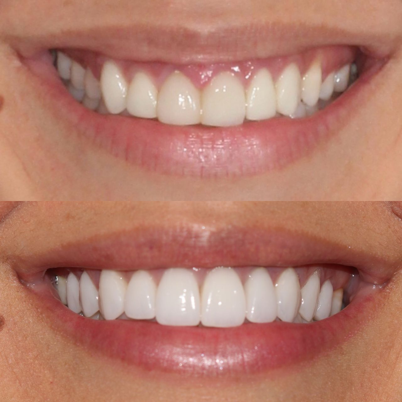 Caroline Benedeti-21