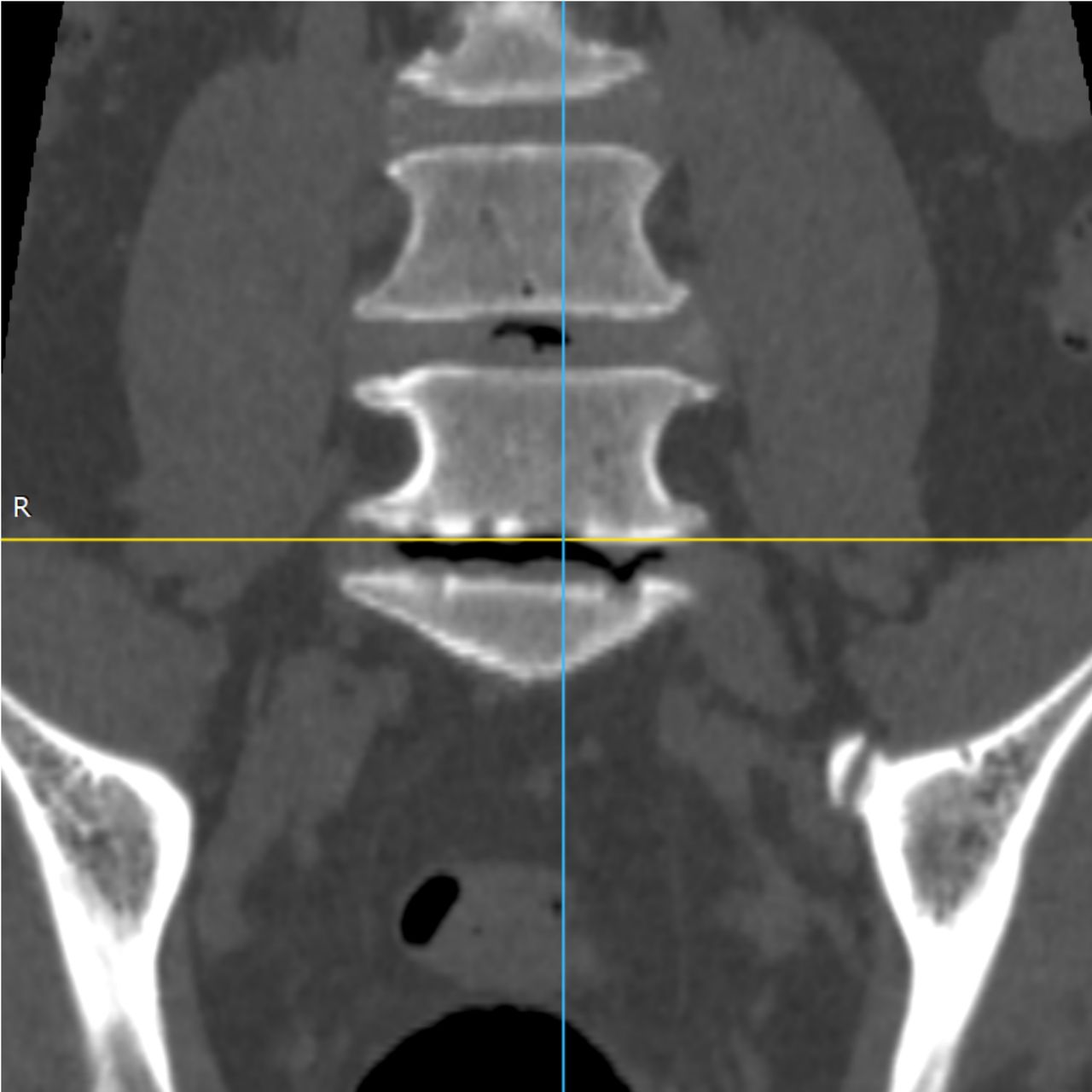 David Tafur Muñoz-2467