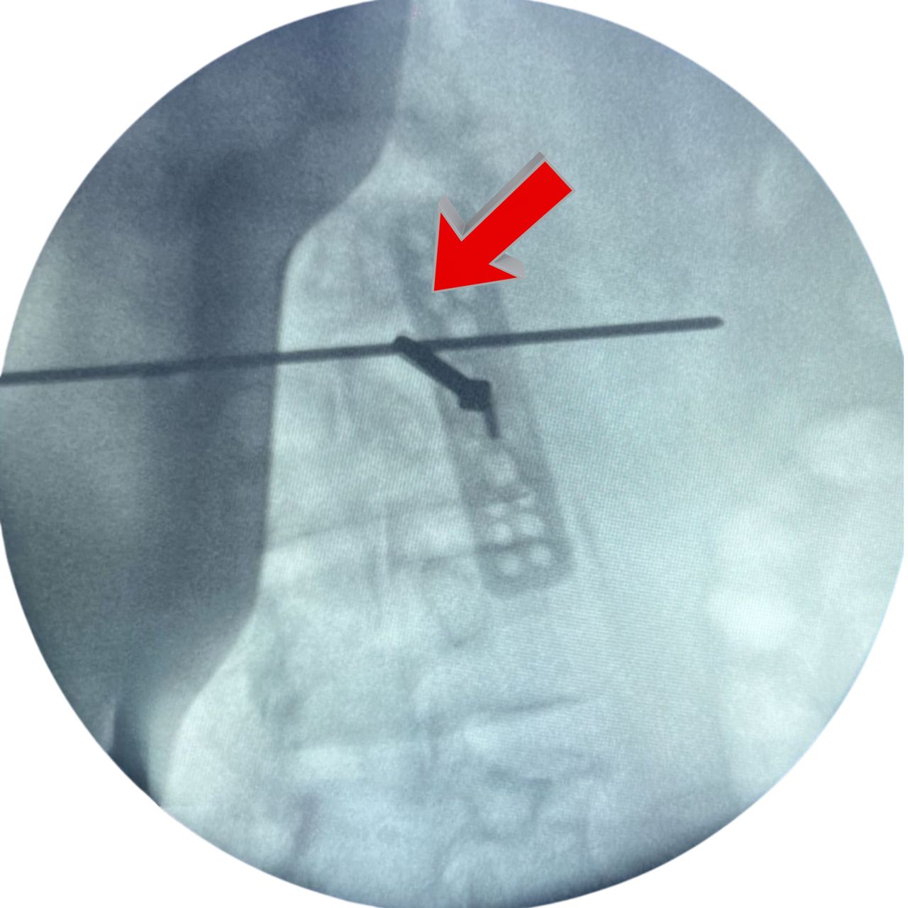 David Tafur Muñoz-1678