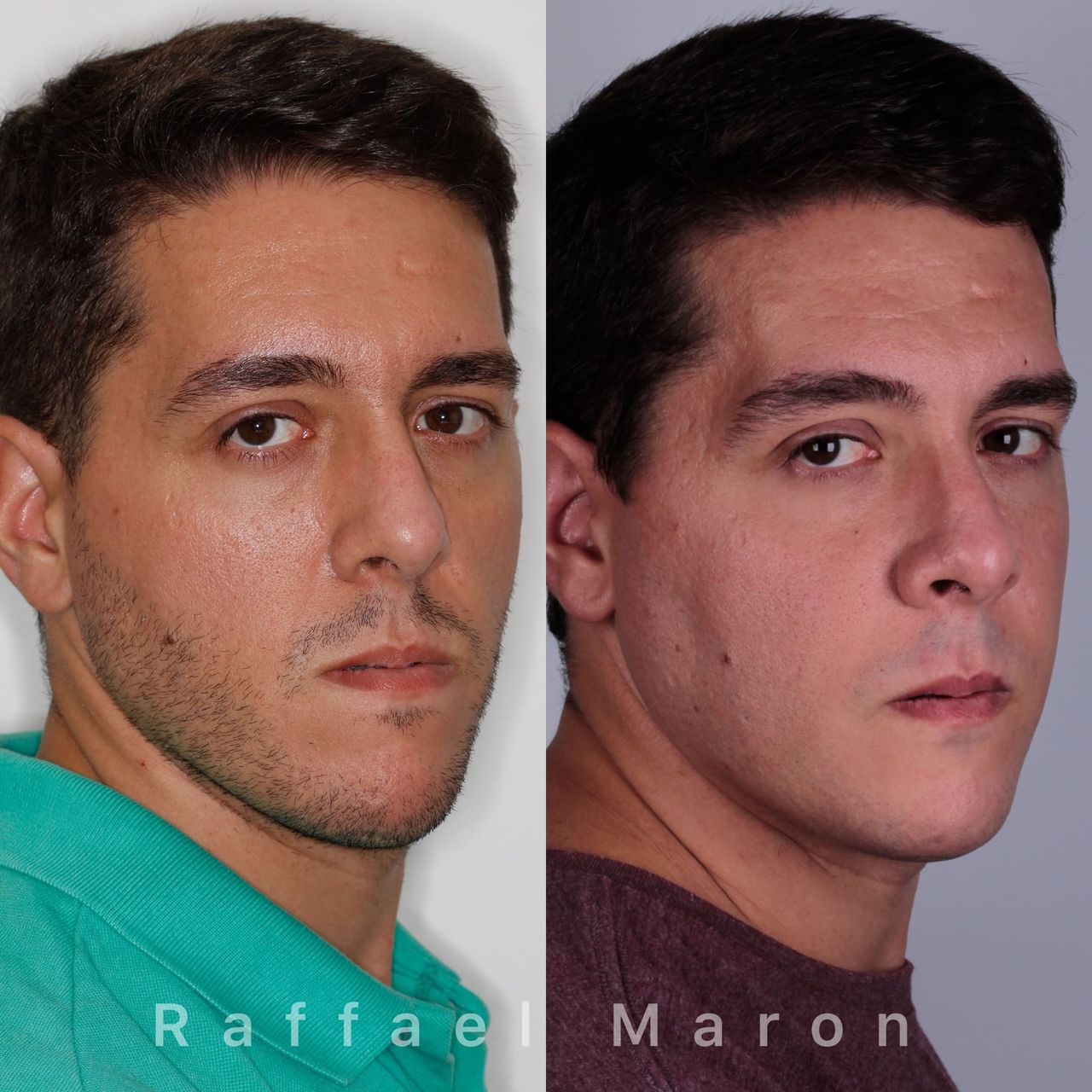 Raffael Maron Vieira De Noronha-13