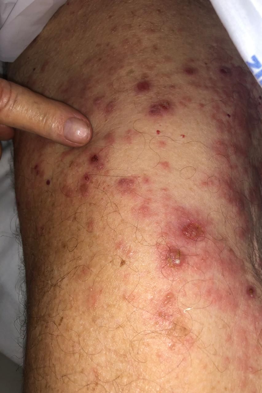 Larissa Cau Carlet-9