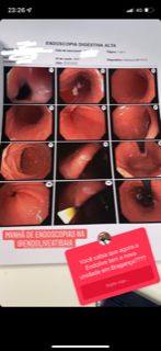 Guilherme Amadeu Poleto-10