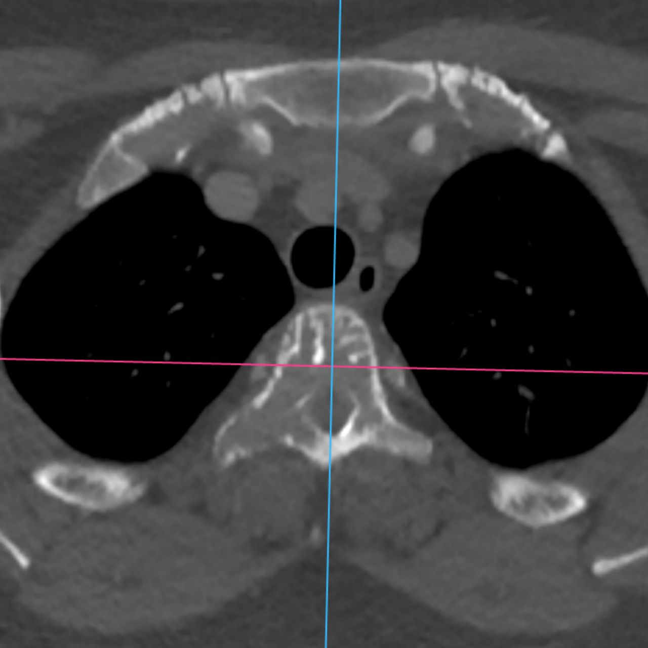 David Tafur Muñoz-2487
