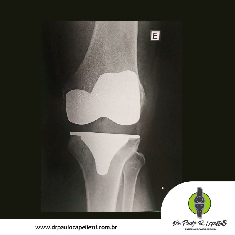 Paulo Roberto Capelletti-69