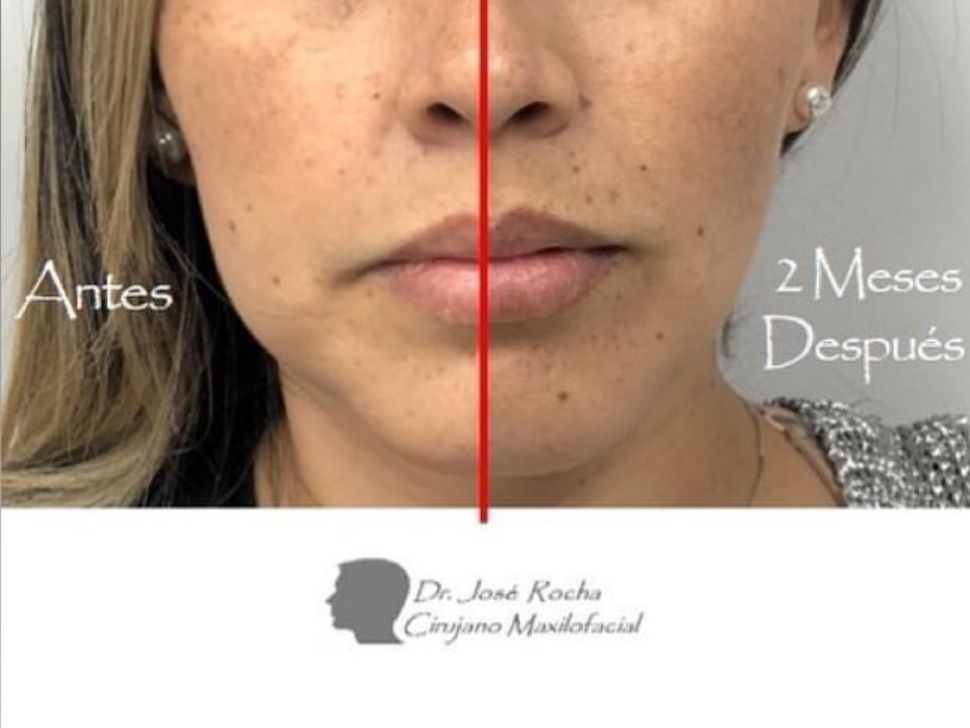 Jose Vicente Rocha Fernandez-41