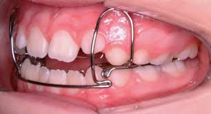 Daniela Hildebrand-18