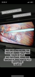 Guilherme Amadeu Poleto-6