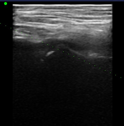 Aarón Núñez Osses-10