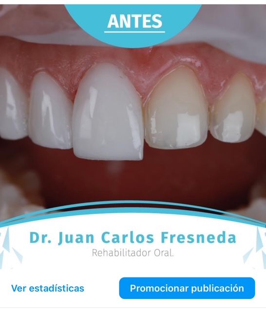 Juan Carlos Fresneda Bonilla-3