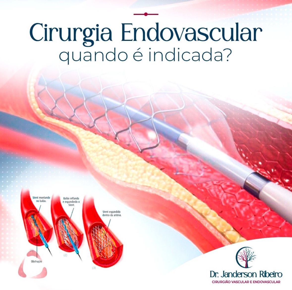 Janderson Ribeiro Fernandes-12