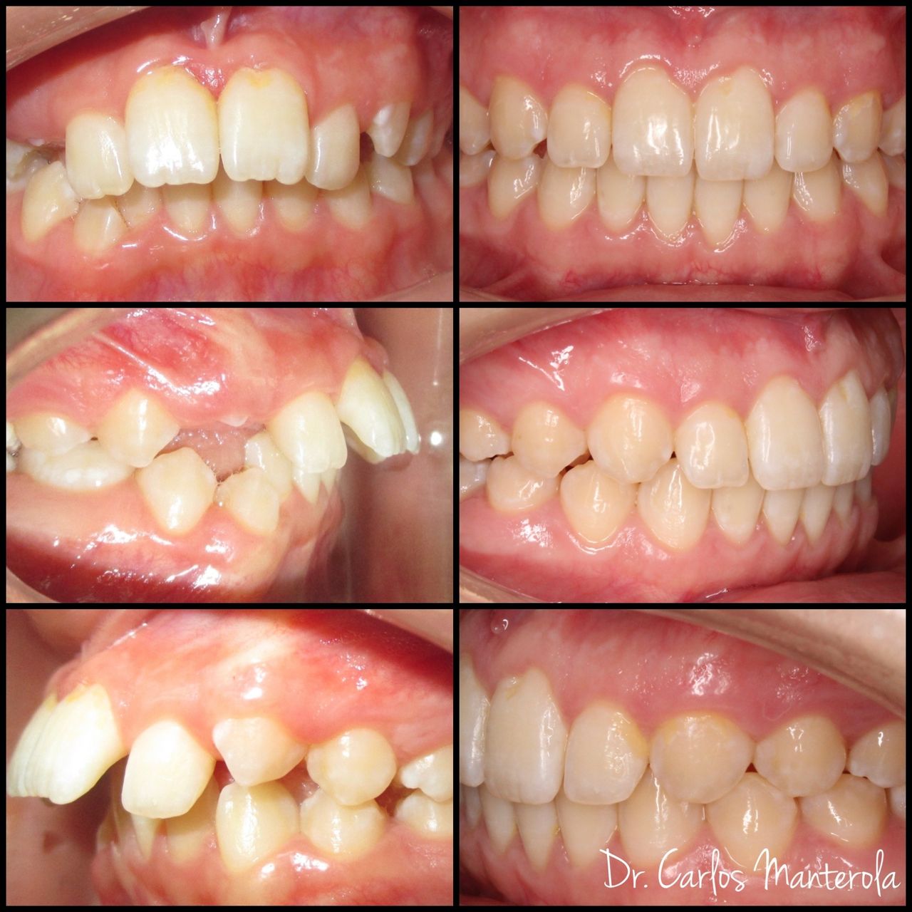 Carlos Manterola Marchant-12