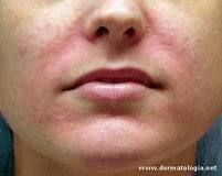 Antonio Carlos Biel-24