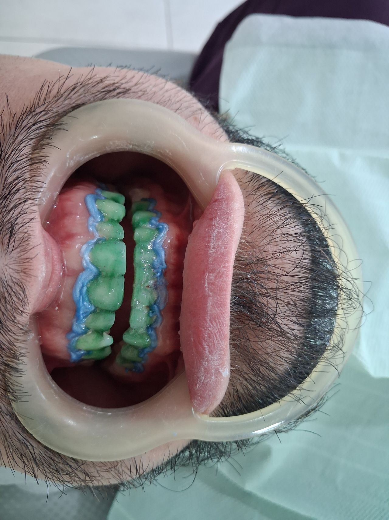 Jonatan Franco Ferreira-0