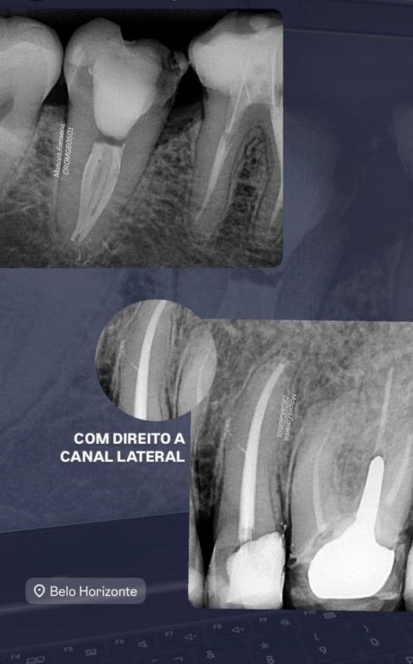 Marcos Vinícios Fonseca Chaves-0