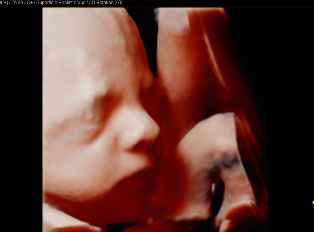 Jonh Harold Alvis Botello-4