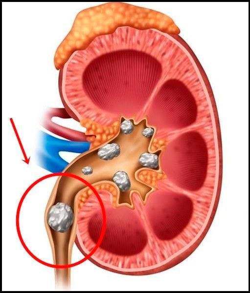 Angelo Palma Contar-6