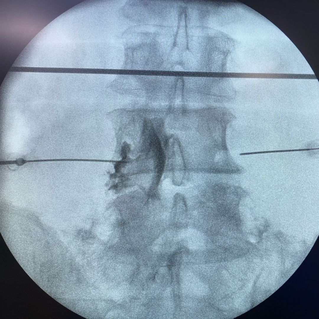 David Tafur Muñoz-2196