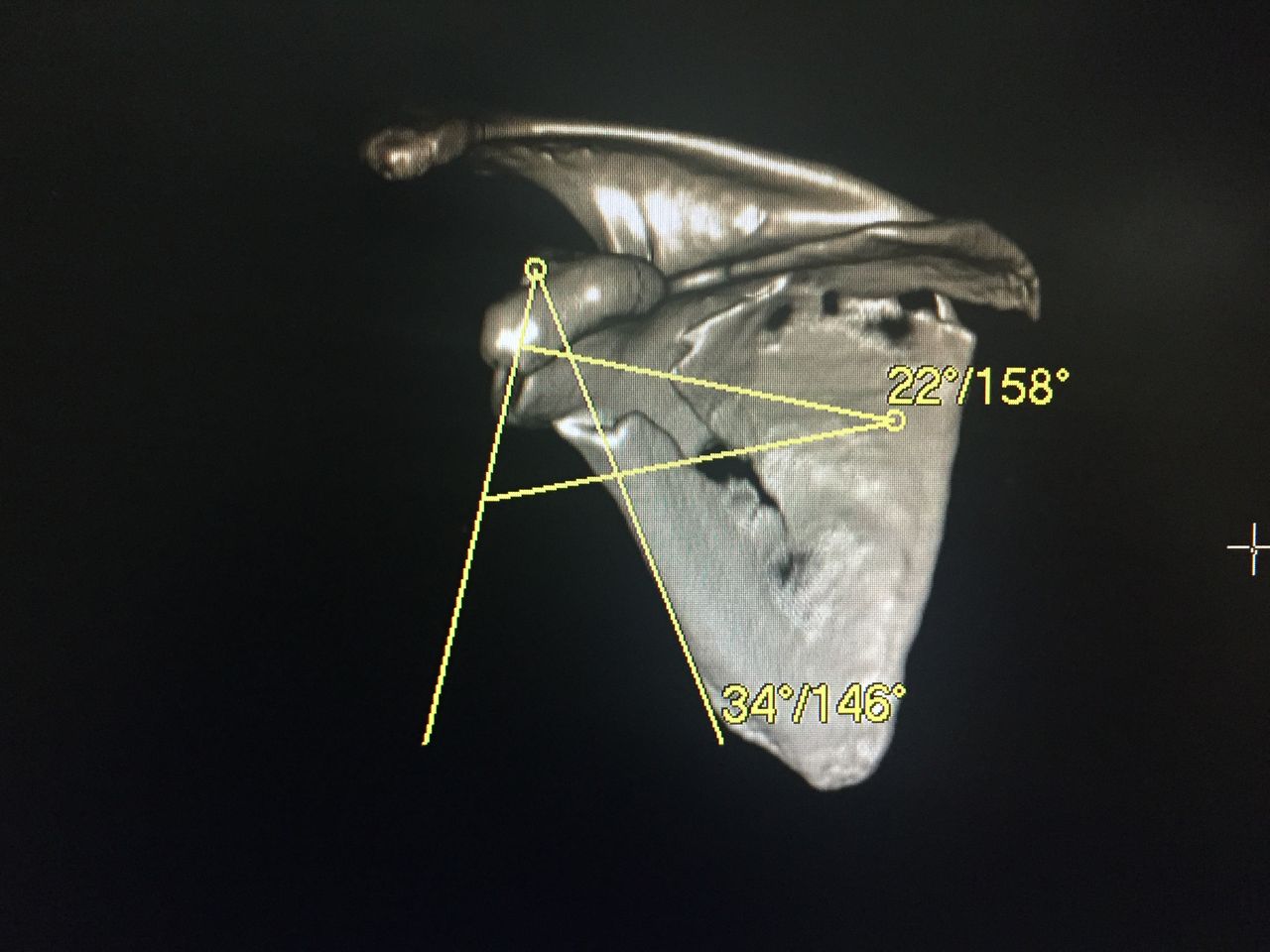 Andres De La Espriella Rosales-24