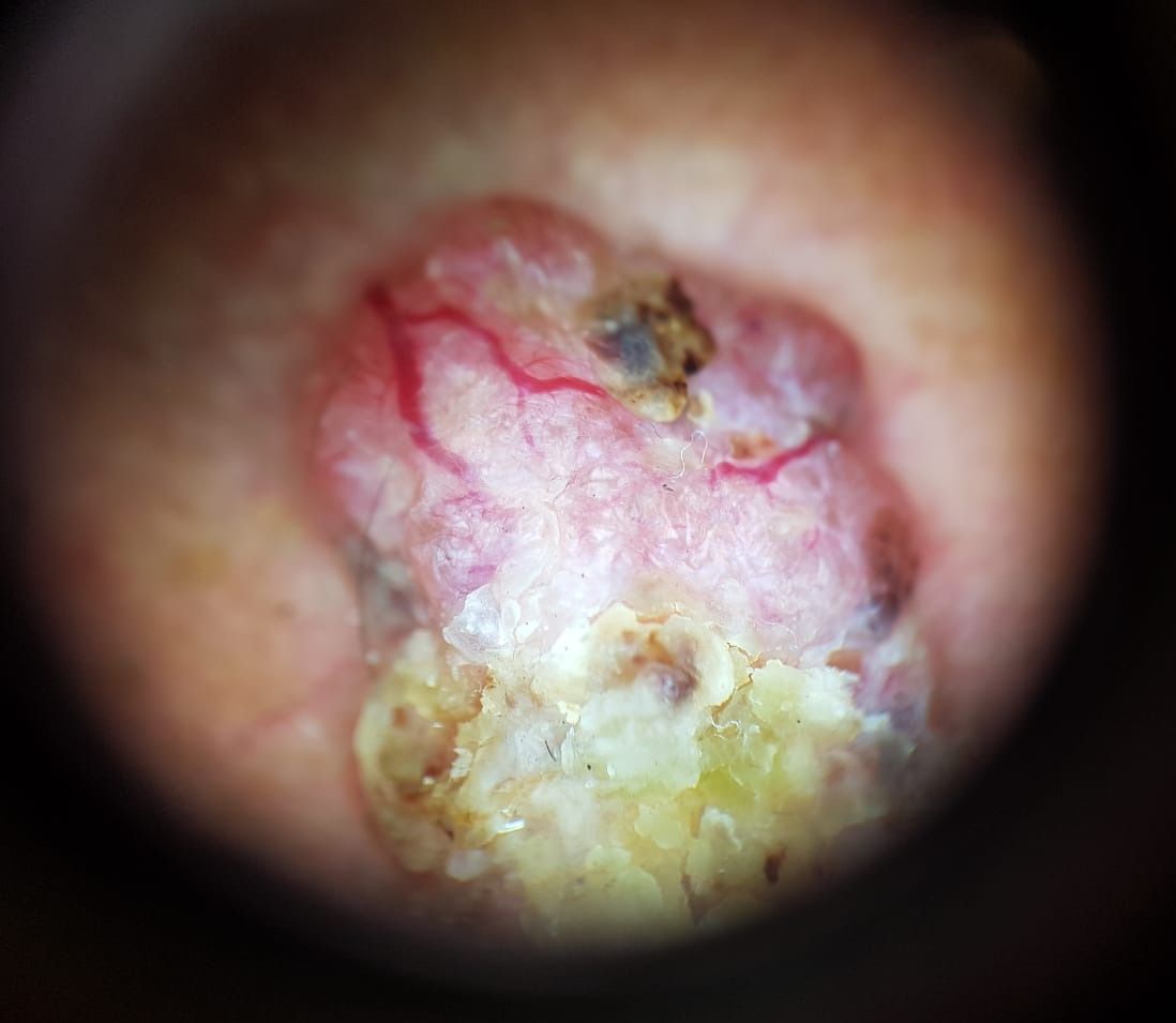 Marcos Ortiz Perez-9