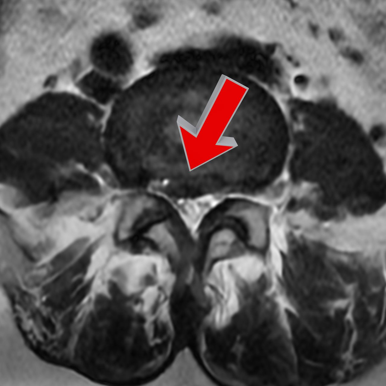 David Tafur Muñoz-2198