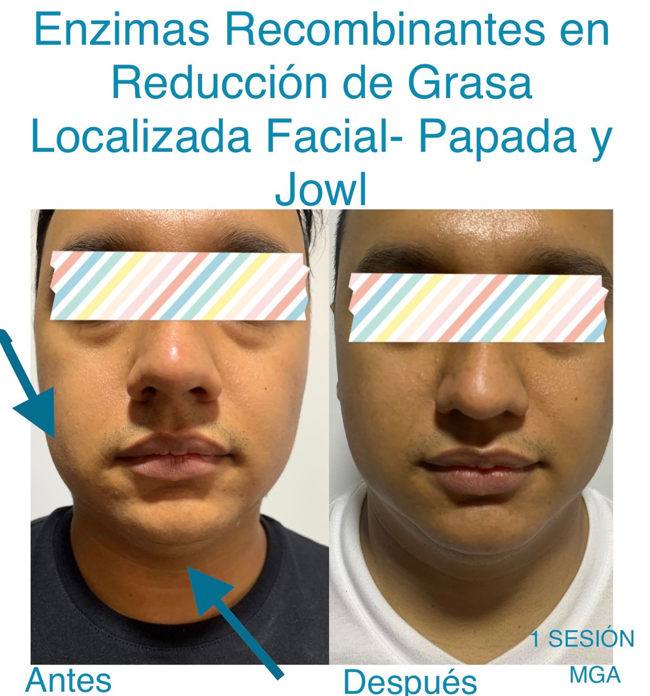 Maria Gisela Angel Losada-9