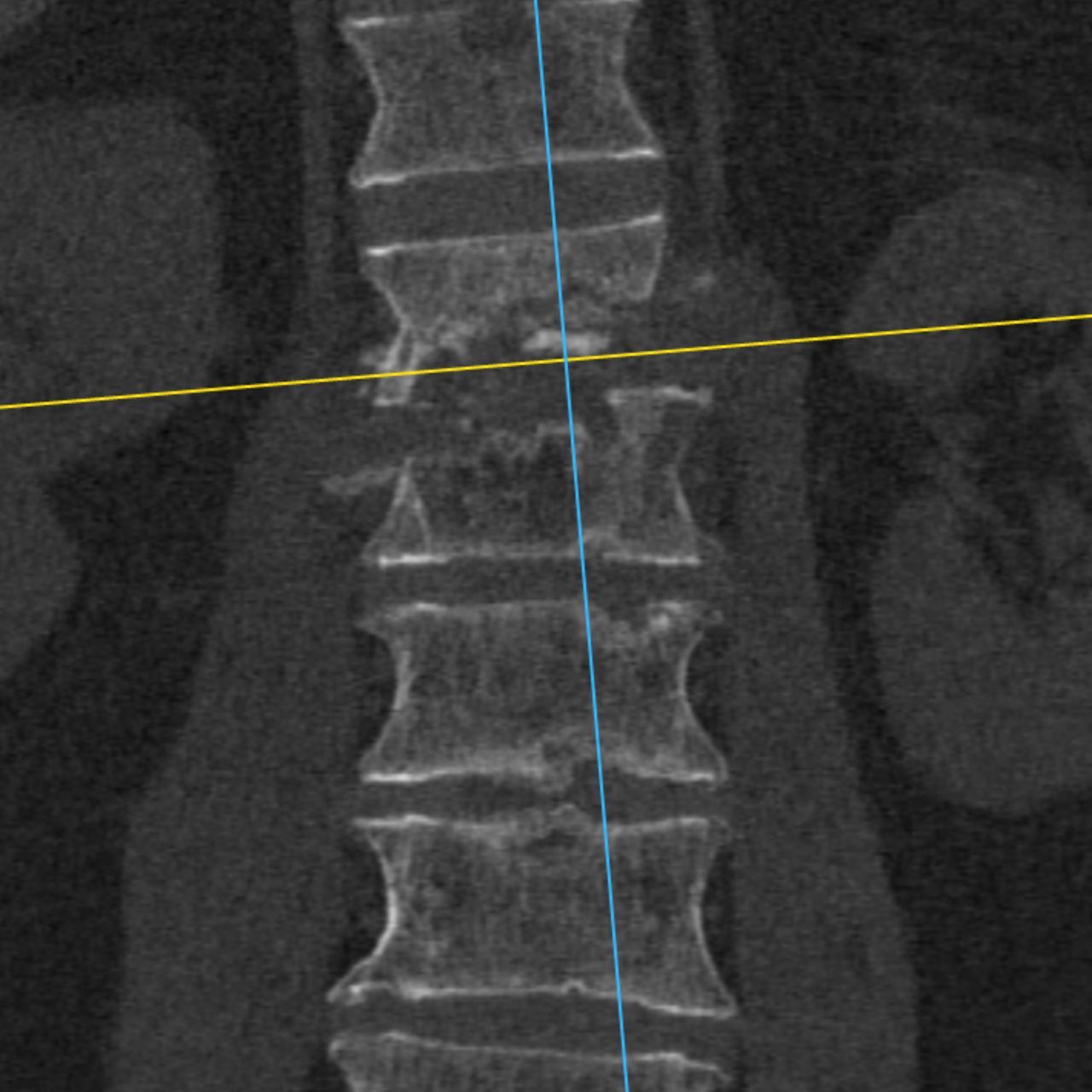 David Tafur Muñoz-1433