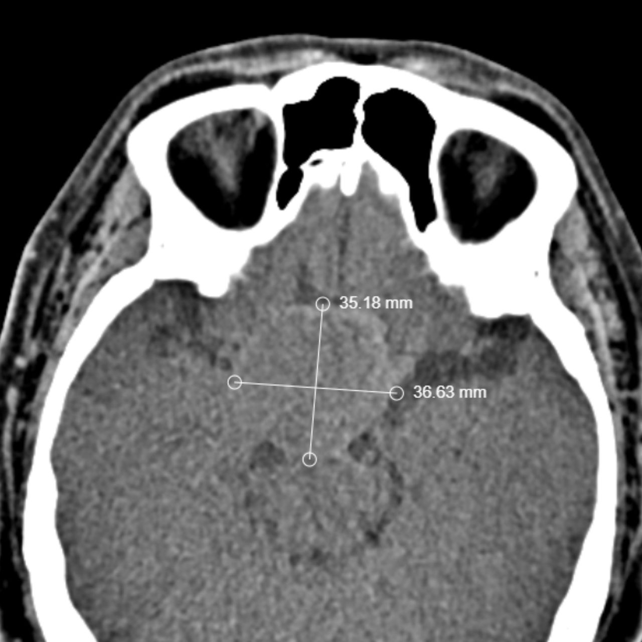 David Tafur Muñoz-1644