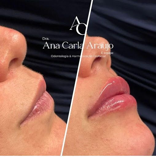 Ana Carla Rocha De Araujo-1