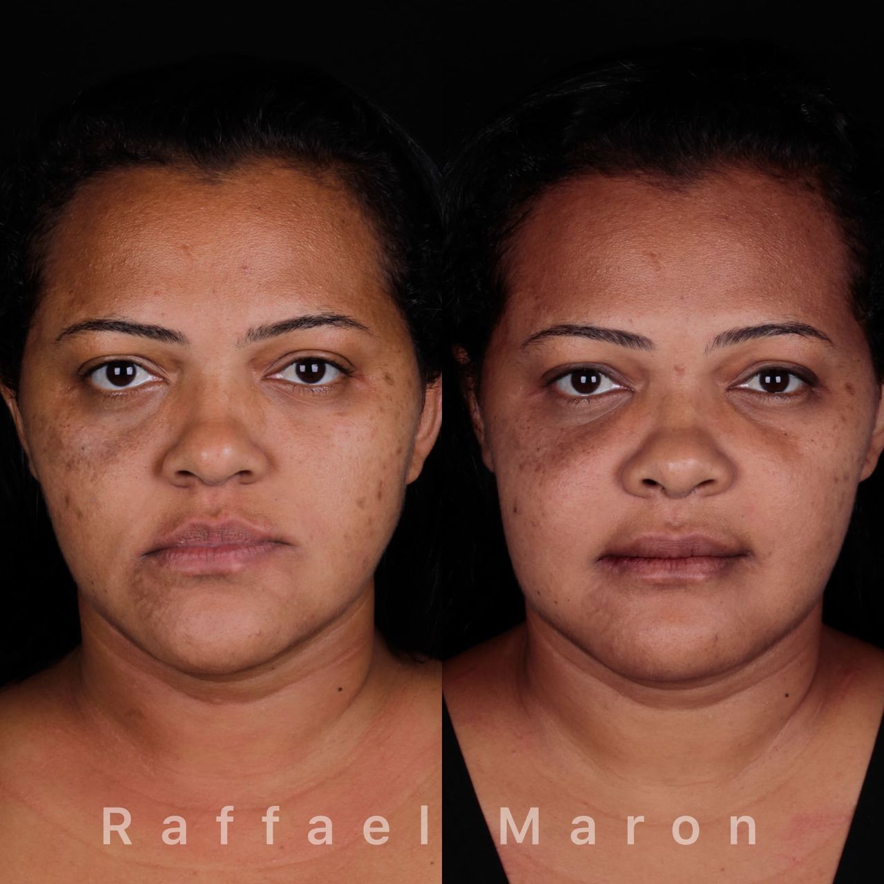 Raffael Maron Vieira De Noronha-24