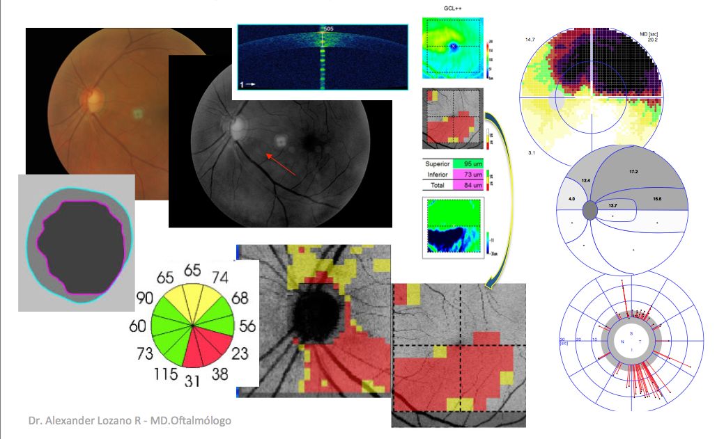 Alexander Lozano Rendon-7