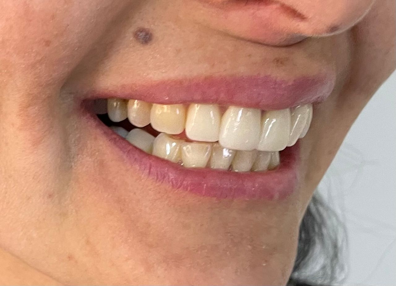 Luciano Varas Salinas-34