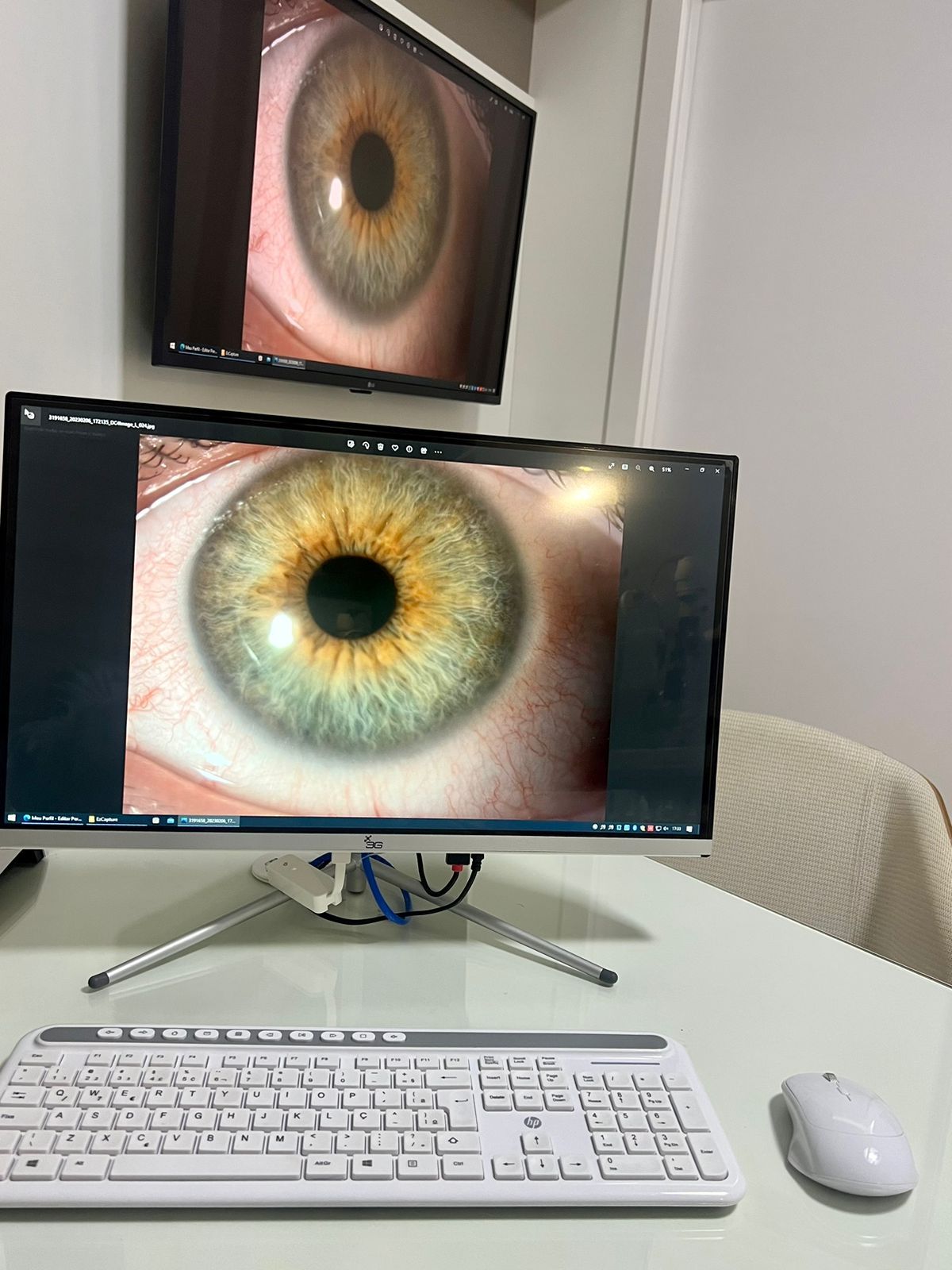 Gilberto Tesser Augusto-3