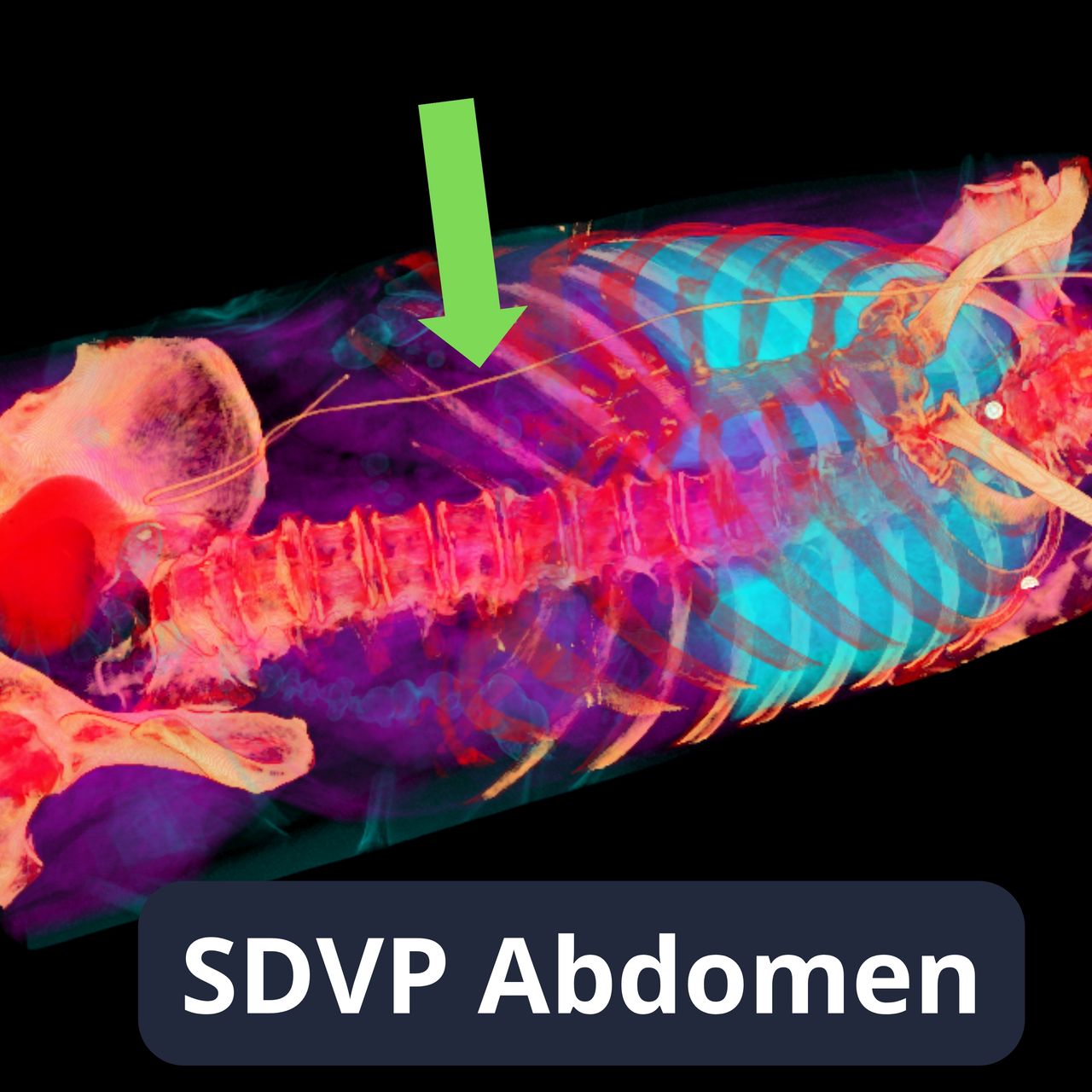 David Tafur Muñoz-2358