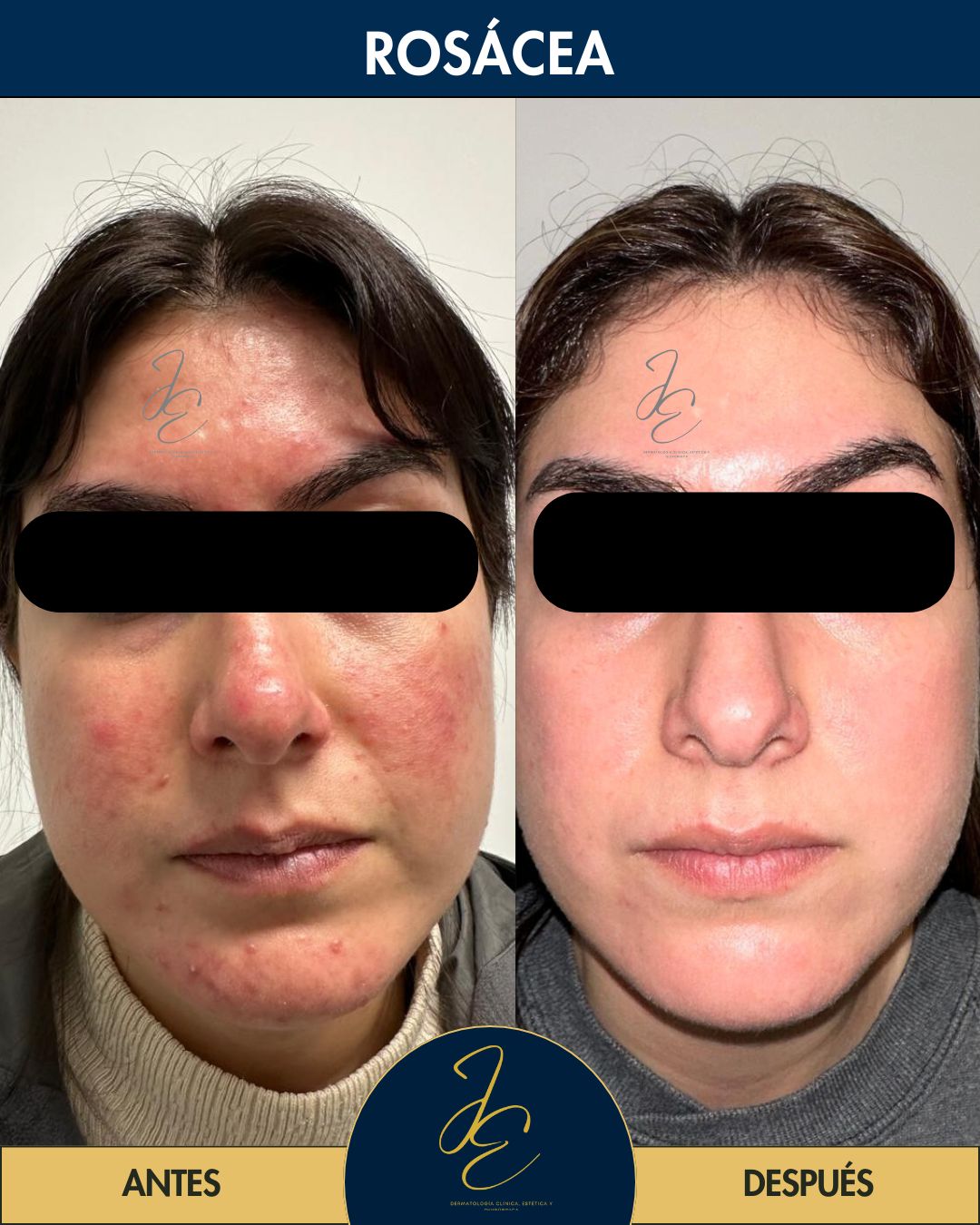 Jeanny Epieyu Diaz-10