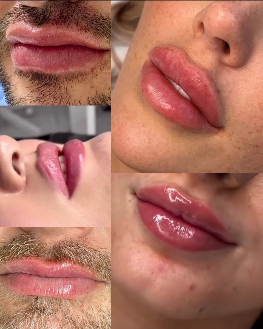 Rosana  Da Fonseca Leivas -2