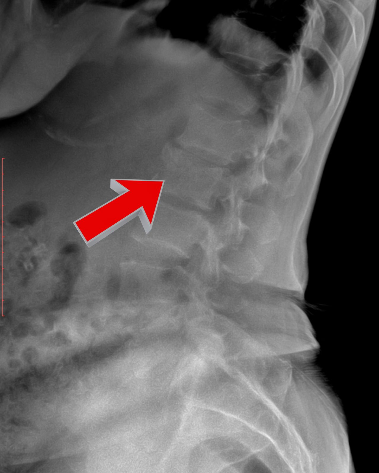 David Tafur Muñoz-1998