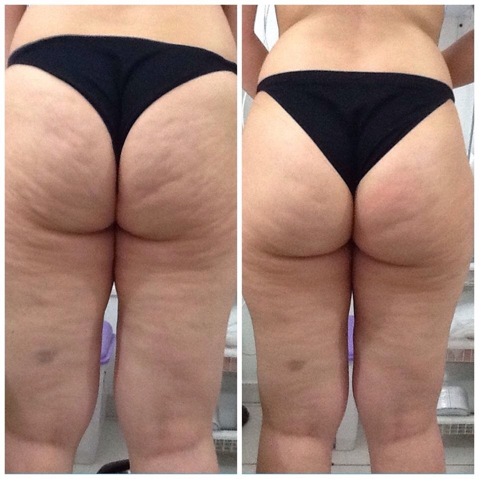 Ana Cristina Maia De Oliveira-6