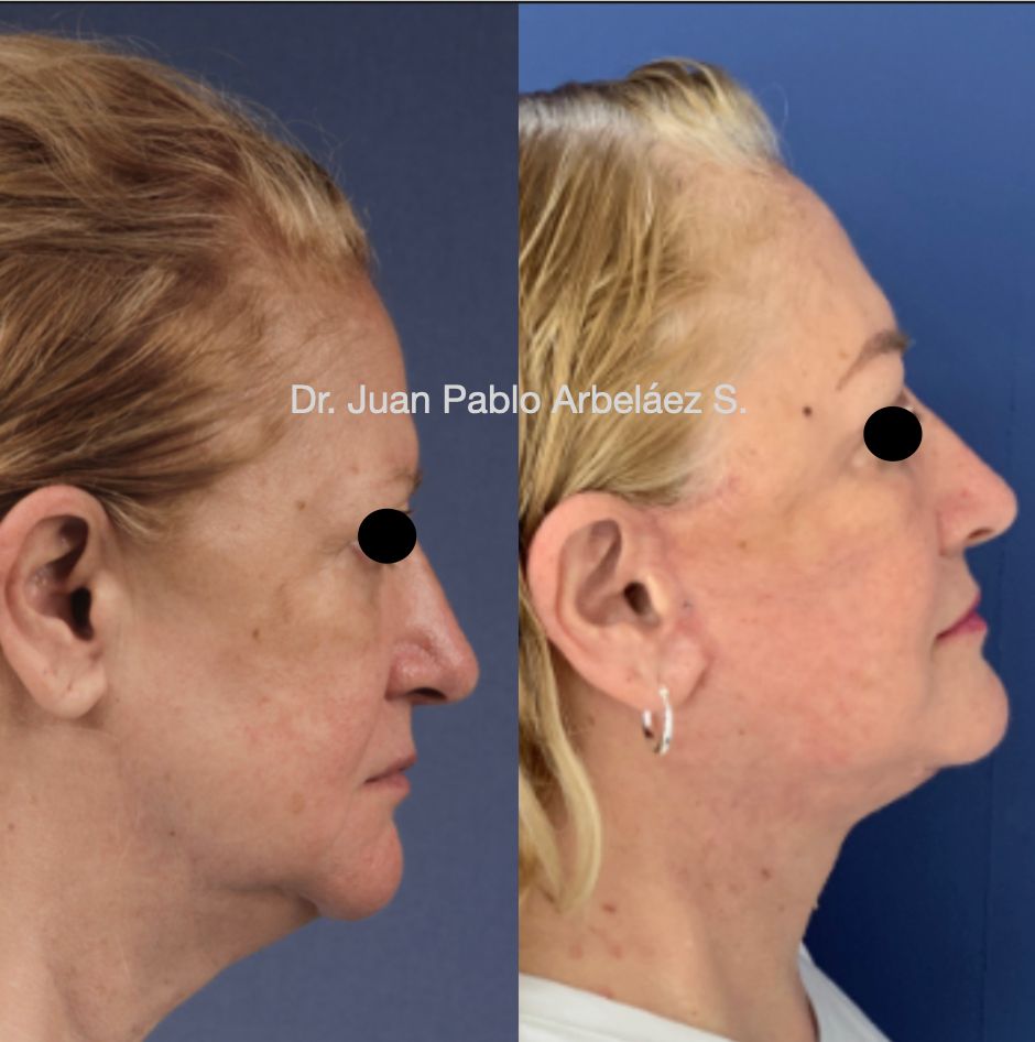 Juan Pablo Arbeláez Sierra-37