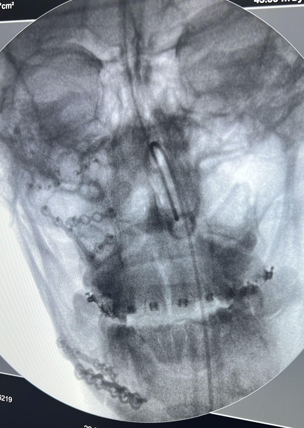 Rafael Meira Pimentel-5
