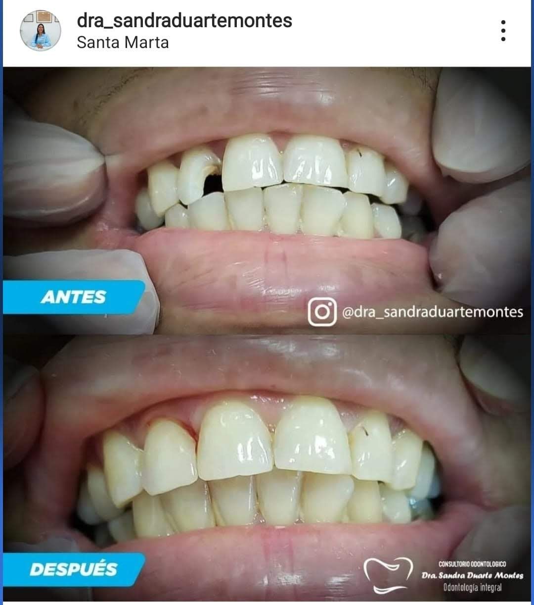 Sandra Duarte Montes-12