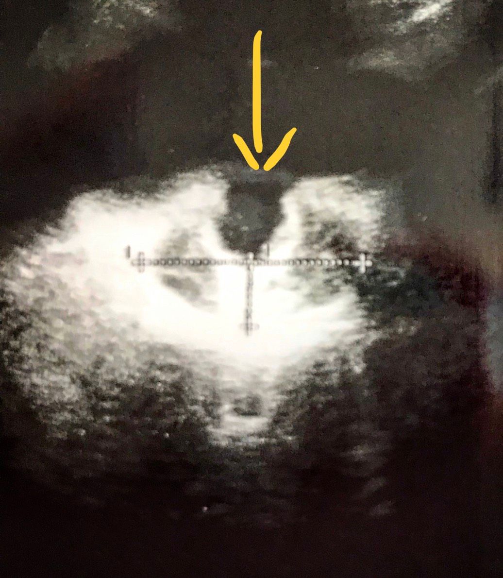 Juan Guillermo Velásquez López-23