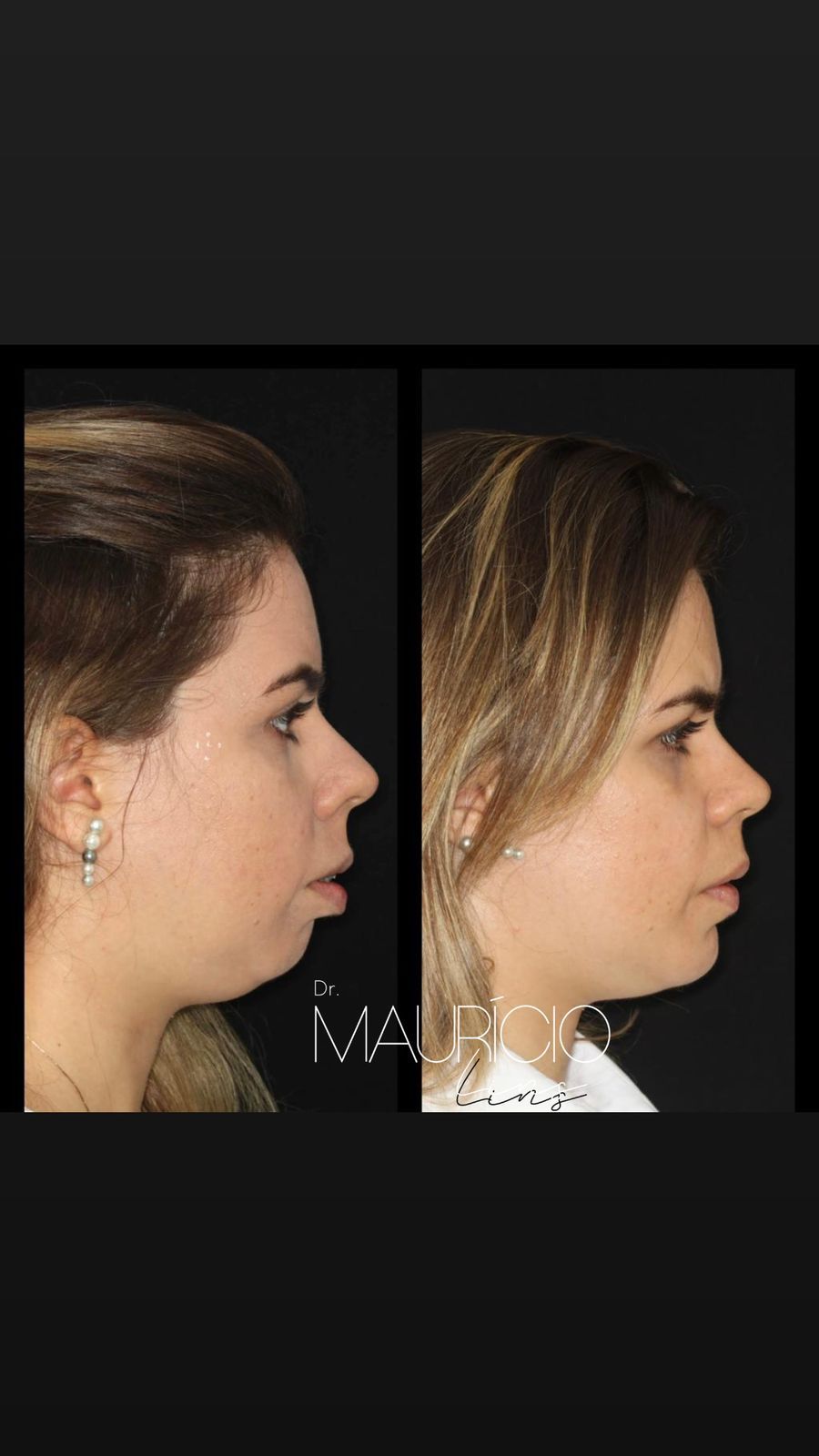 Mauricio Lins Moura-3