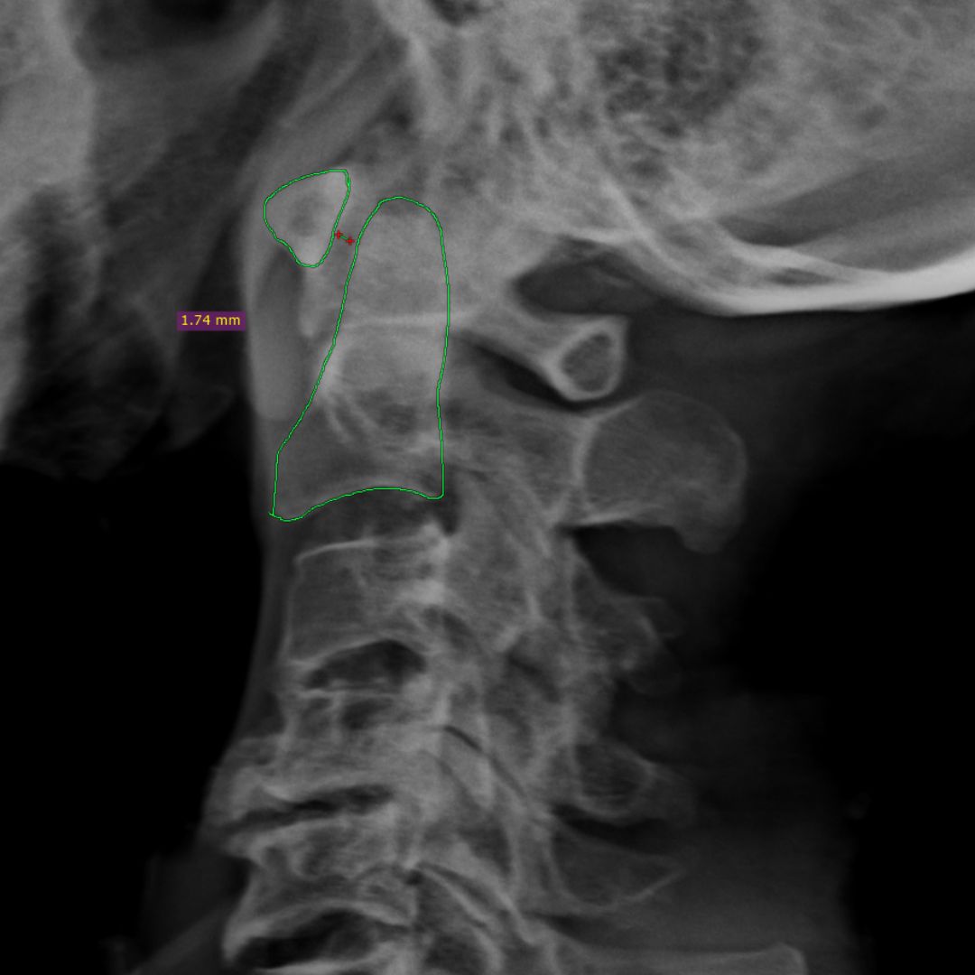 David Tafur Muñoz-2310