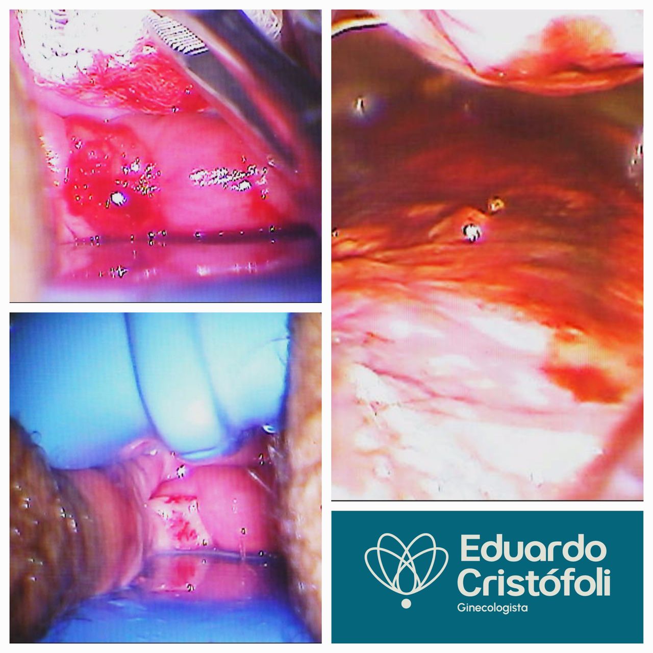 Eduardo Cristófoli Silva-15