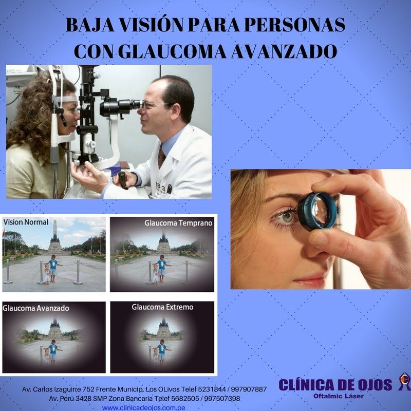 Edgar Angel Hidalgo Pecho-14