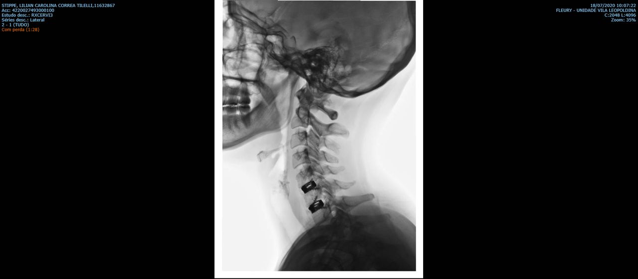 Allan Hiroshi De Araujo Ono-2