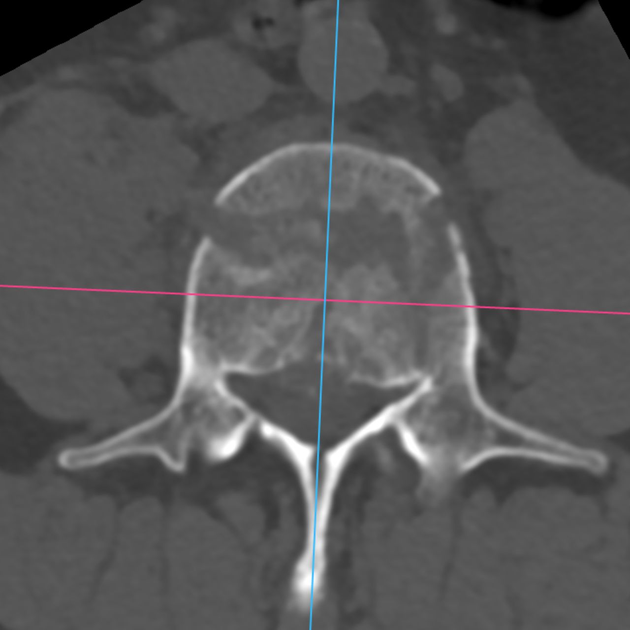 David Tafur Muñoz-2163