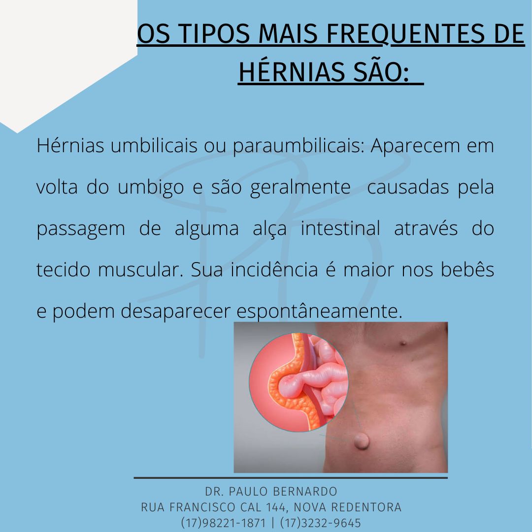 Paulo Leandro Alves Bernardo-7