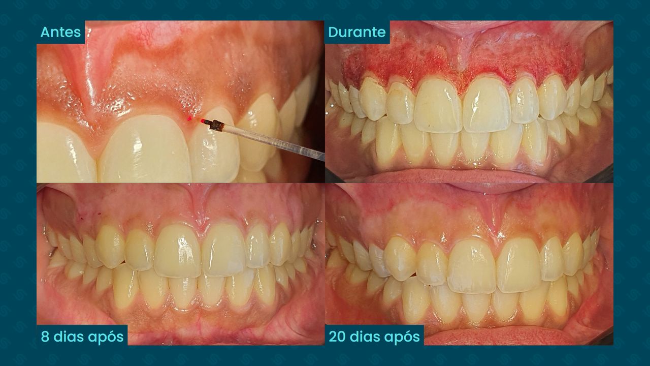 Luis Mario Lopes-22